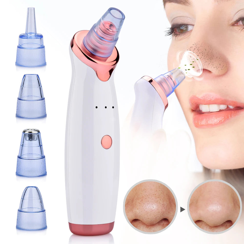 GlowClean – odkurzacz do zaskórników i trądziku